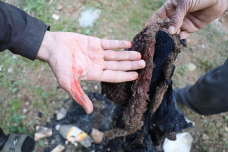 A piece of bloodied textile, which looks like the hood of a woollen jacket, is held up next to the palm of a man’s hand with blood streaked on it