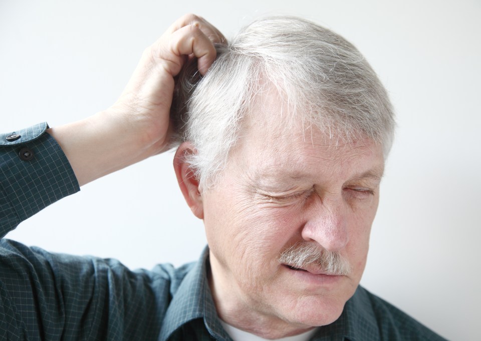 Senior man scratching his itchy scalp.