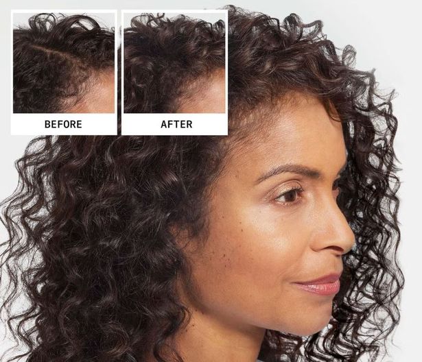 Before and after results using the shampoo, conditioner and serum