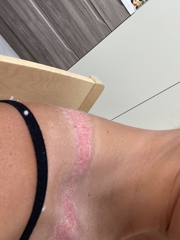 The marks