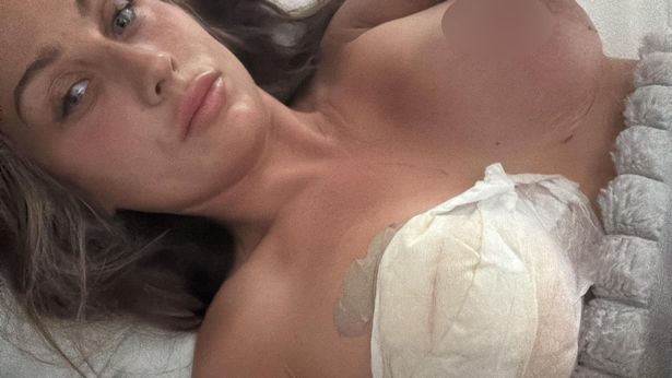 Chloe, 31, is pictured in hospital in Turkey