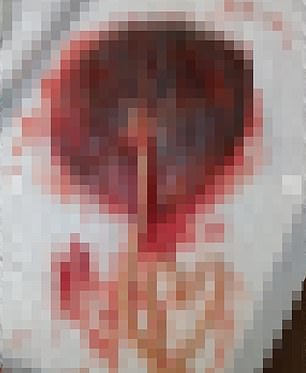 Calvin shared a graphic photograph of Vick's placenta