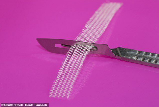 Polypropylene pelvic mesh implants have been linked to chronic pain and other side effects in women