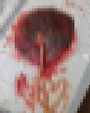 The placenta was later turned into pills by drying and grinding the organ into a powder that's then encapsulated