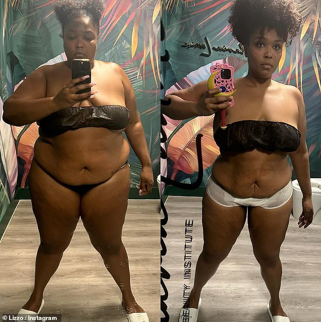 Lizzo recently shared a dramatic before and after post showing off her weight loss. She said 'training 3x a week' and staying in a 'calorie deficit' helped her achieve her goal