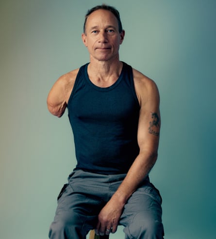 Jim Ashworth-Beaumont photographed before the fitting of his manually adapted prosthetic arm in October 2024