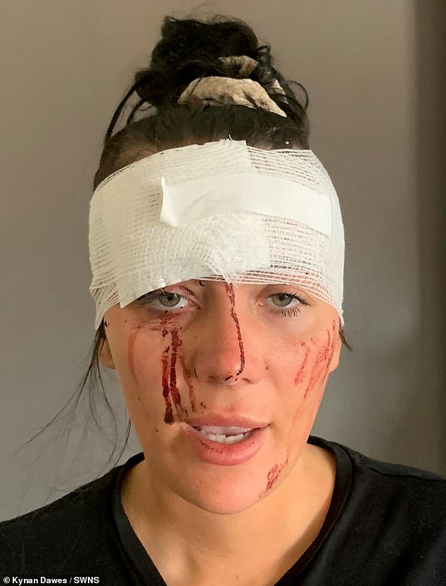 Just 11 days before her suicide, Kiena suffered an horrific head wound after being attacked by her partner (Ms Dawes is seen with blood over her face in an image released by police)