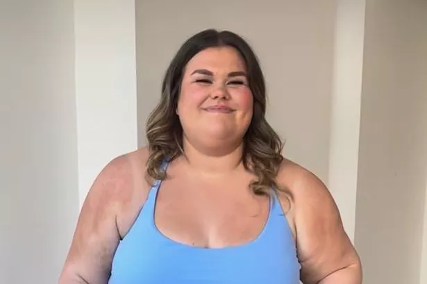 Gogglebox's Amy Tapper wows in sports bra as she plans for surgery to remove loose skin