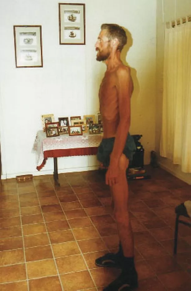 Ricky Megee emaciated