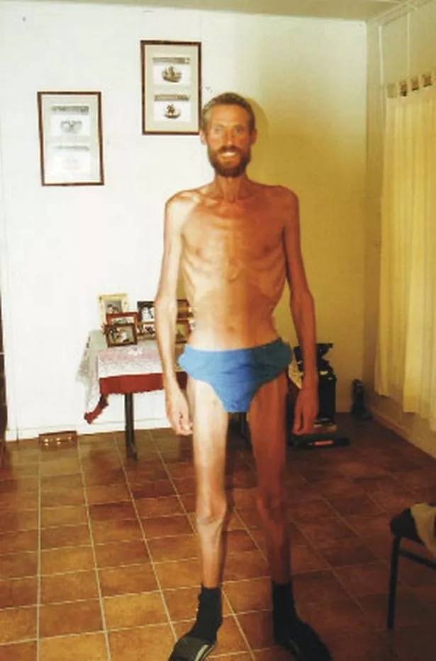 Ricky Megee emaciated