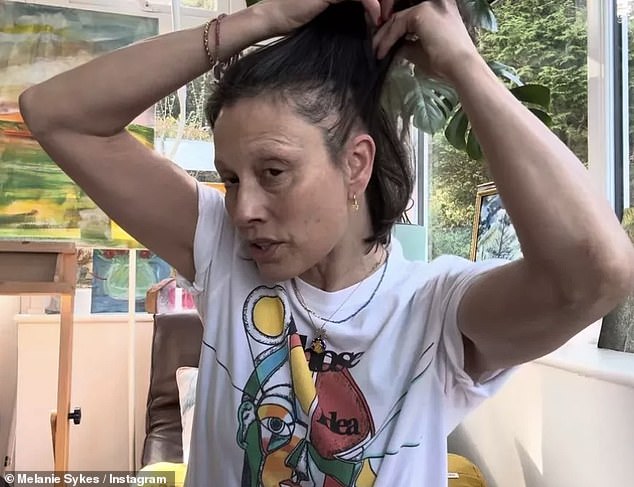 She gave an insight into her hair loss in April and showed her side profile, where she pointed out the bald spot on her head